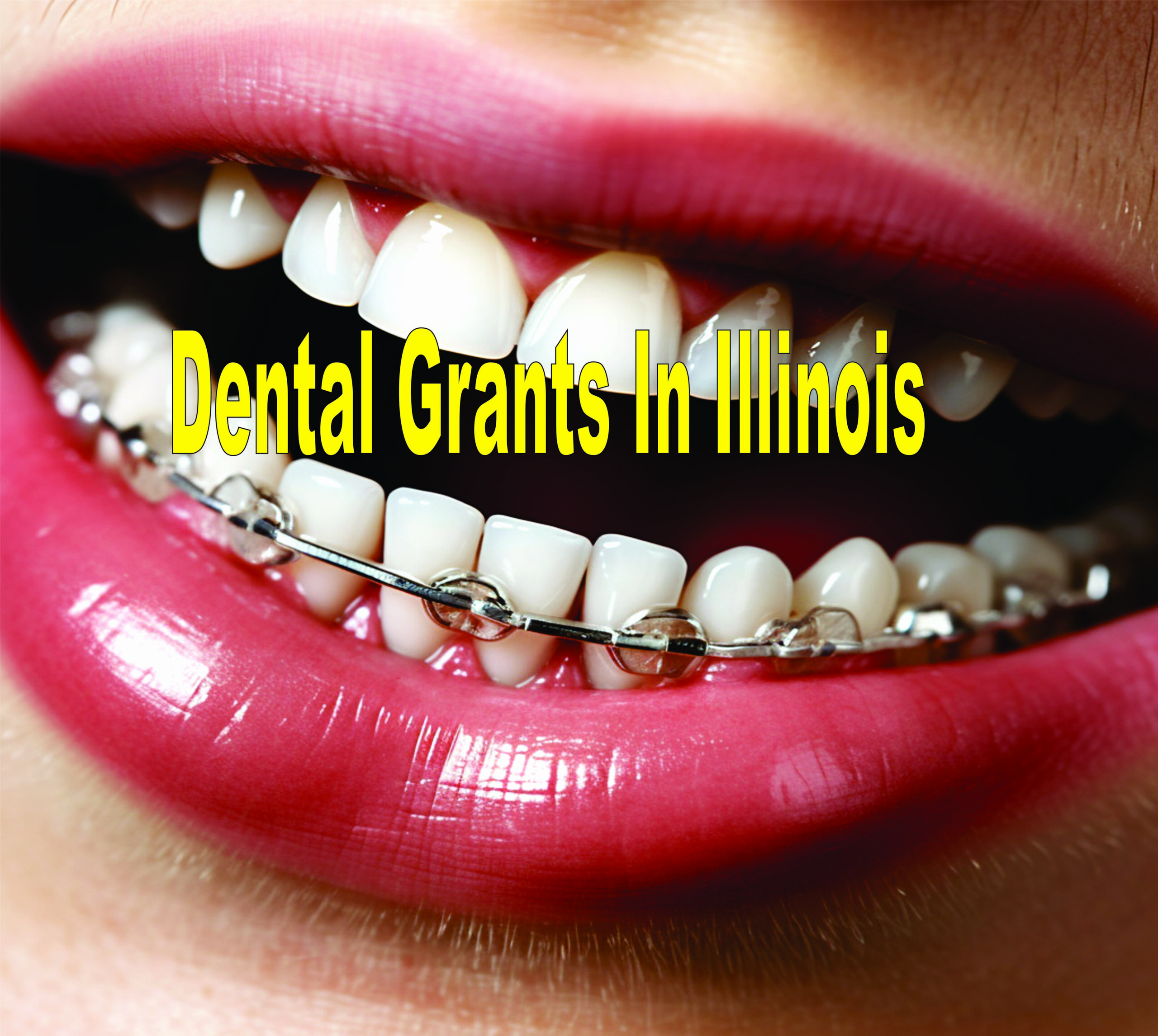 Dental Grants In Illinois