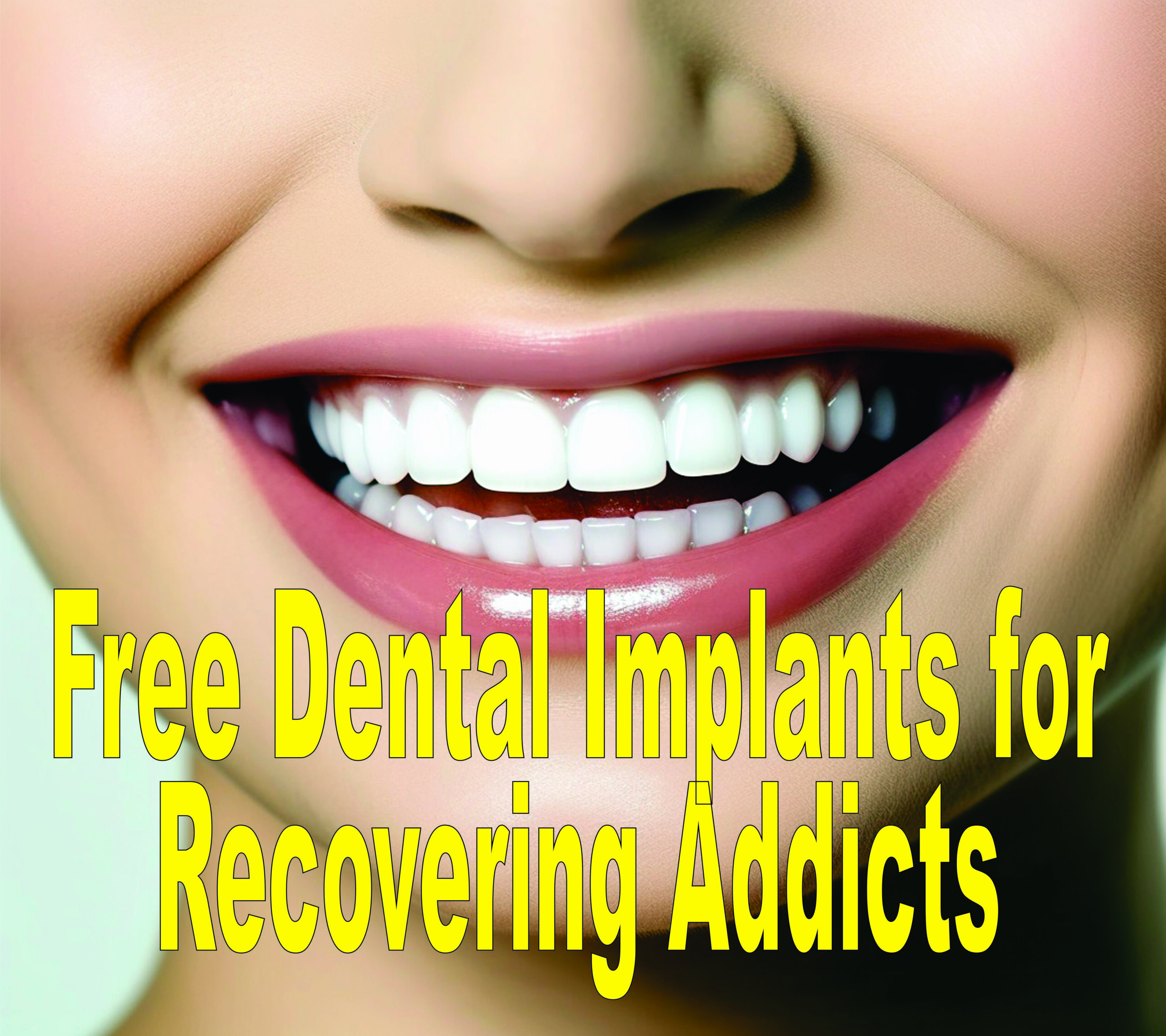 Free Dental Implants For Recovering Addicts
