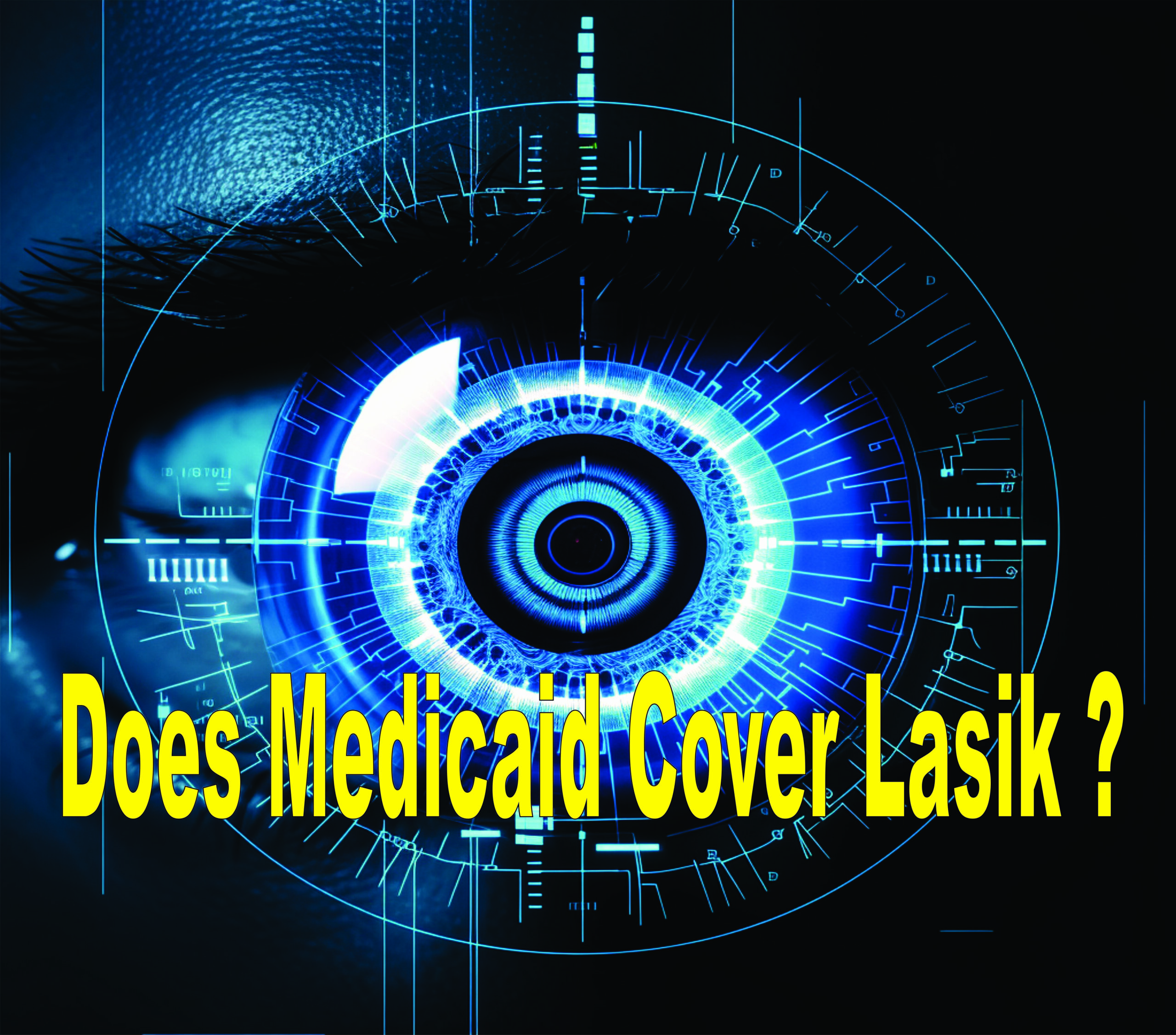 Does Medicaid Cover Lasik