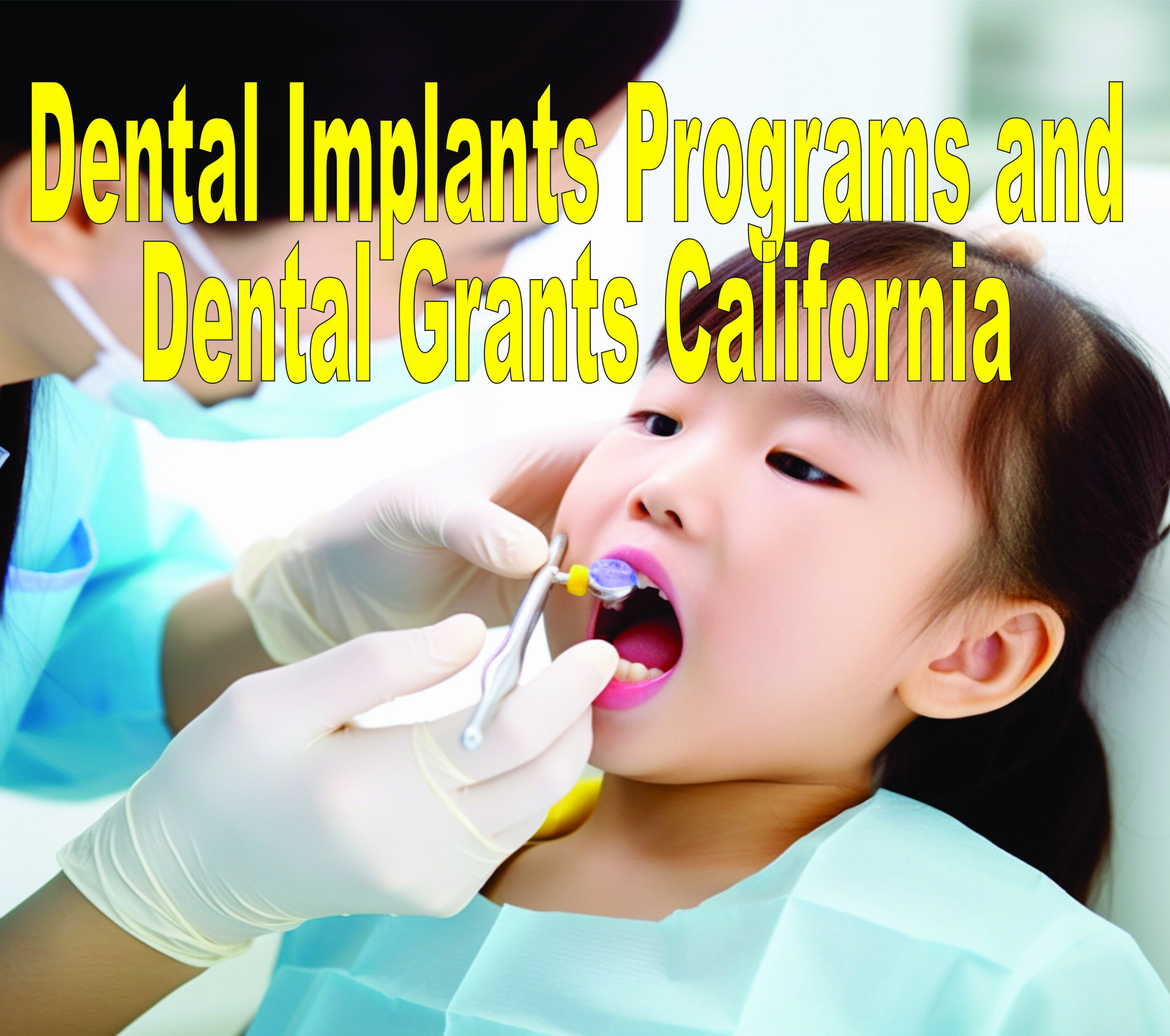 Dental Implants Programs And Dental Grants California