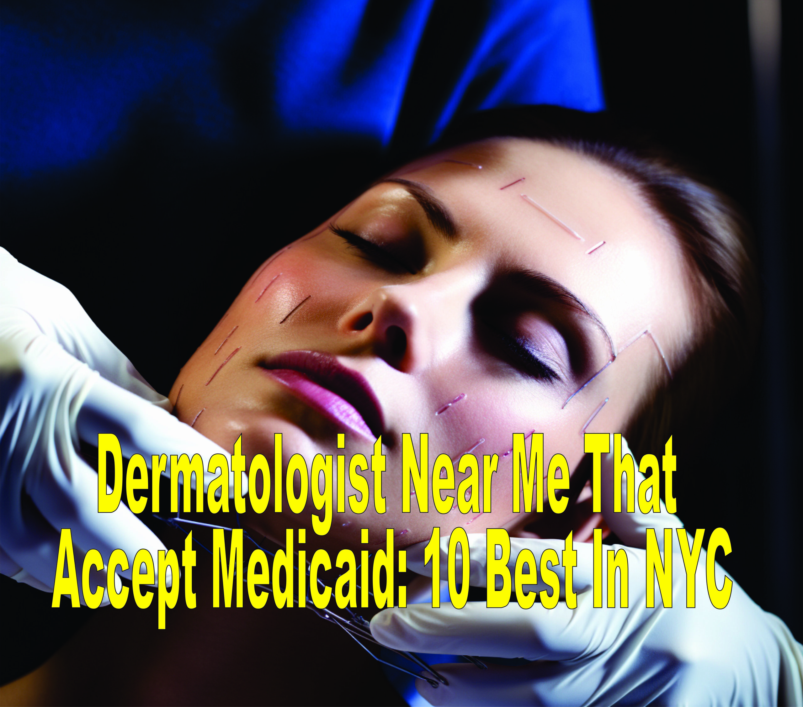 Dermatologist Near Me That Accept Medicaid 10 Best In Nyc